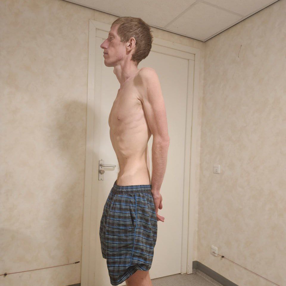 Алексей во время голодовки. Фото из личного архива героя