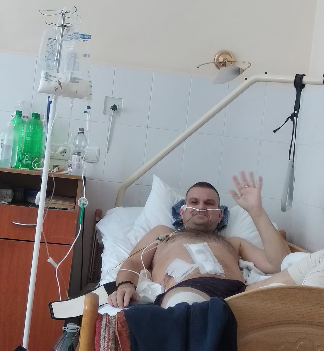 Андрей после операции. Фото из личного архива