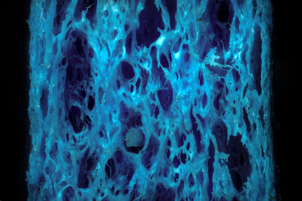 Целлюлоза под микроскопом. Фото: Wikimedia Commons , CC BY 4.0